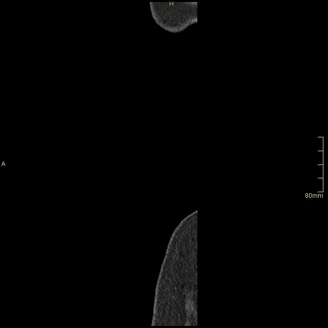 sagittal non con.gif