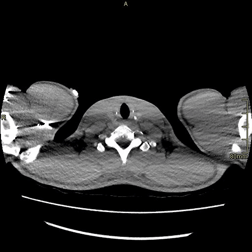 axial soft.gif