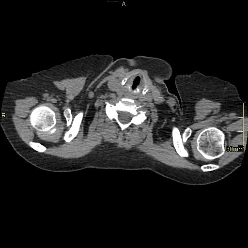 axial soft prone insp.gif