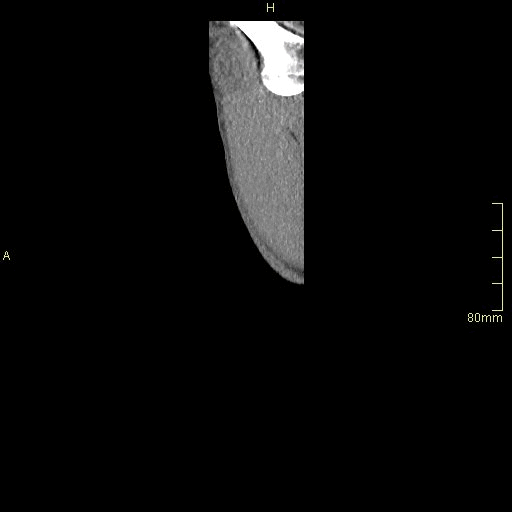 sagittal soft.gif