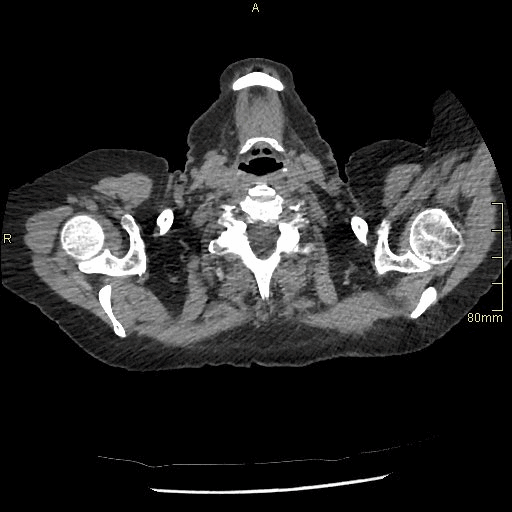 axial soft supine exp.gif