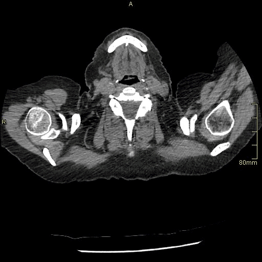 axial soft supine insp.gif