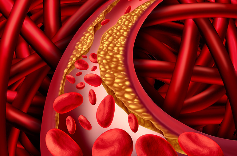 shutterstock_297965735.jpg