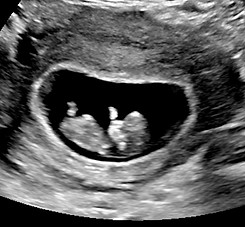 10 weeks.jpg