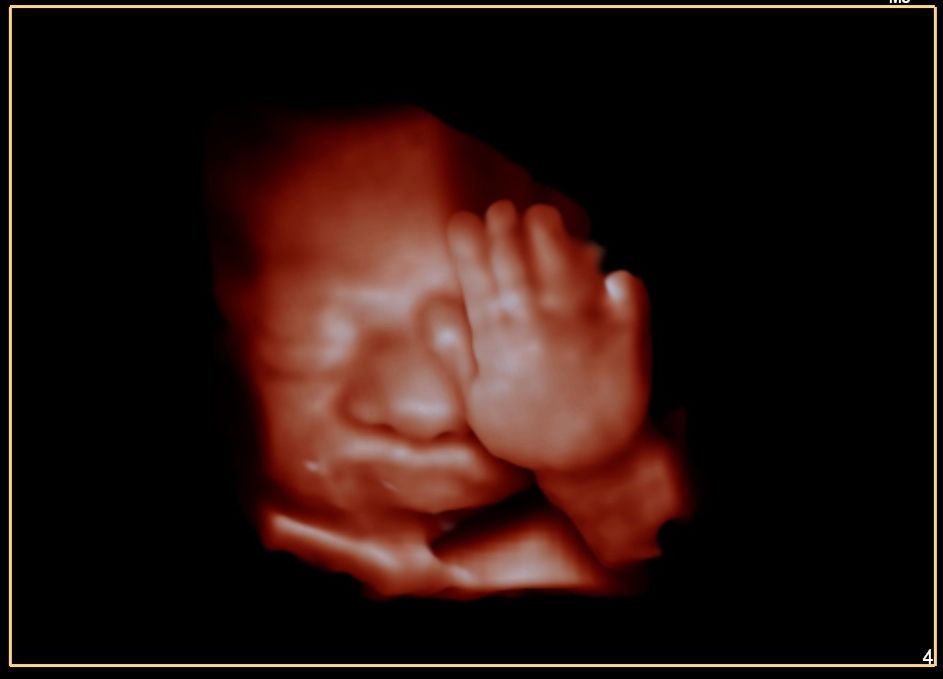 3D4D -28+weeks