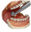 Surgical 45 Drill Highspeed Impact Air
