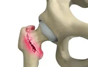 Strong Bones, Longer Life