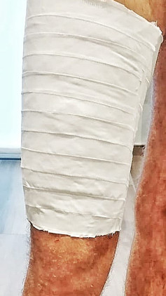 Bendaggio Compressivo