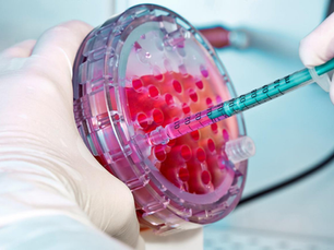 What Are Long-Term Health Benefits of Stem Cells Therapy?