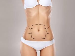 Bra Fat Rolls Treated Through Laser Liposuction