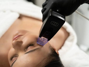 How Does Morpheus8 Address Skin Laxity?