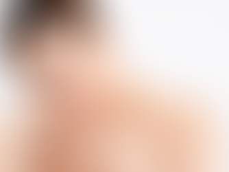 Is Laser Skin Resurfacing Treatment Safe for Dark Skin?