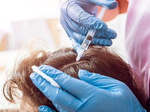 What Happens During a PRP Hair Treatment Session?