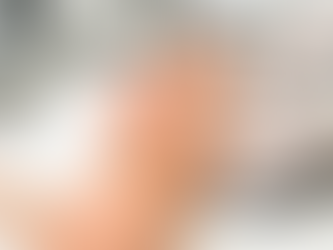 How Does Botox for Sweat Glands Work Medically?