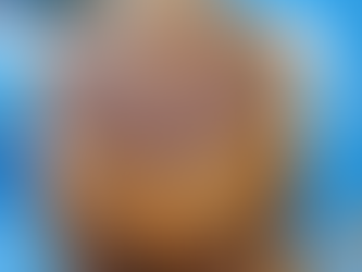 How to Choose a Hair Transplant Clinic?