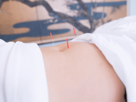Woman receiving acupuncture treatment on her abdomen to support fertility in a serene, calming environment.
