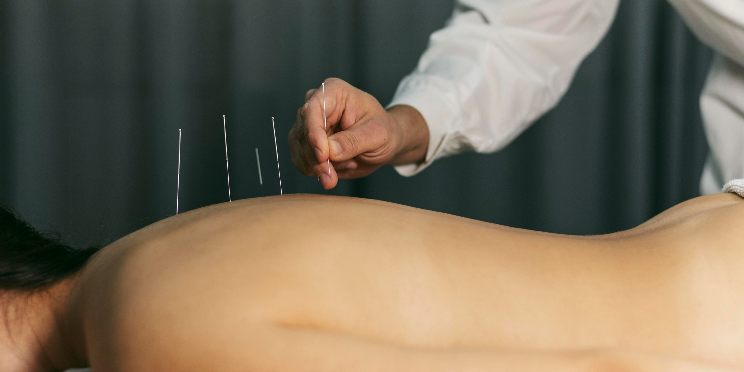 Acupuncture | Zen Attitude Hawaii