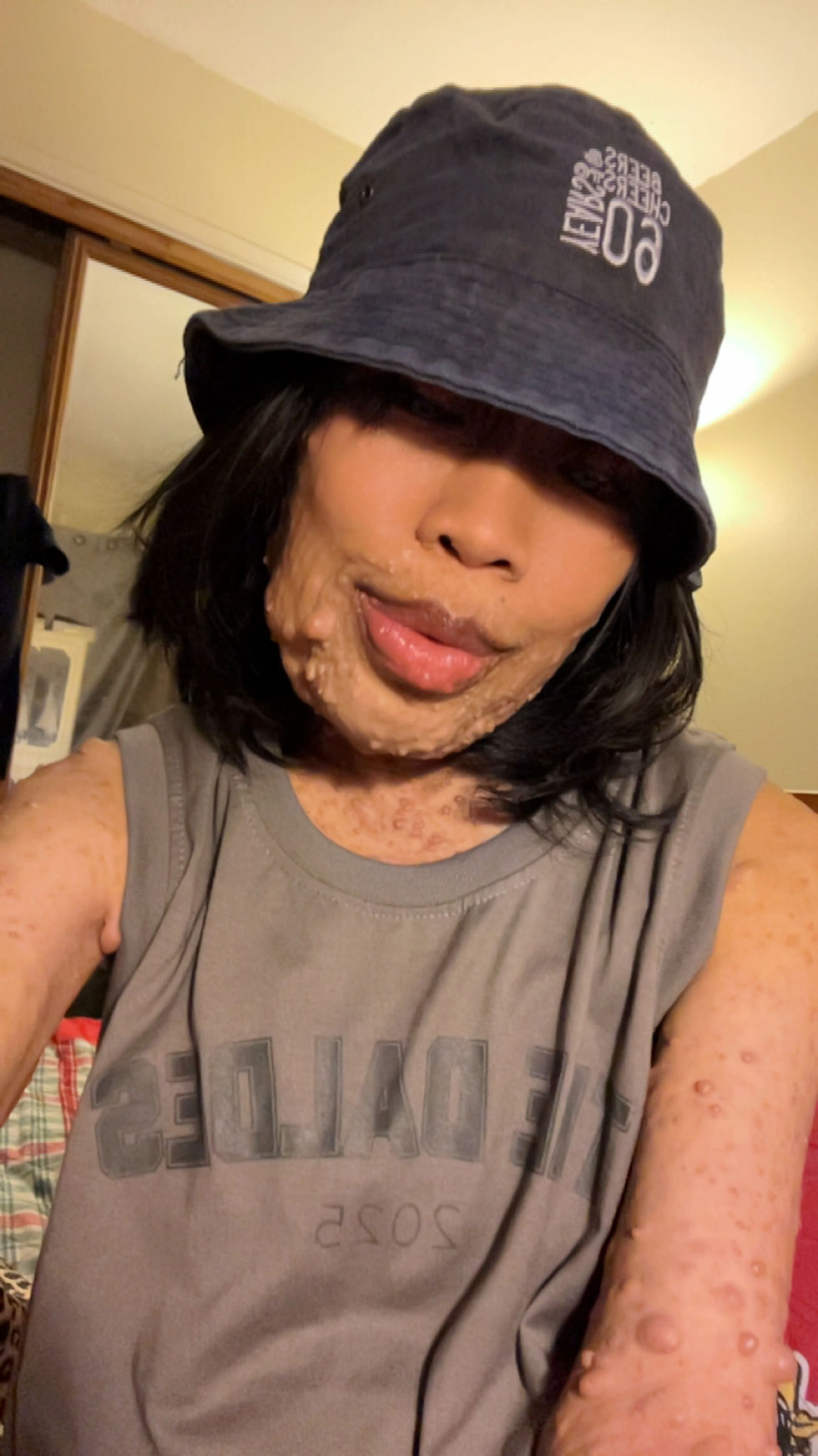 Embracing My Journey with NF: From Roast to Realness