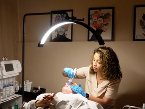 Why Is My Skin Still Peeling 5 Days After Microneedling?