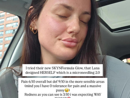 Can You Work Out After Microneedling? What to Avoid for the Best Results