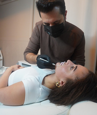 cheek fillers amsterdam noord Revolax.jpg