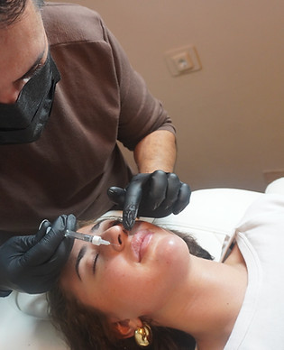 Lip fillers en facial fillers Amsterdam door BIG-geregistreerde arts - natuurlijke resulta