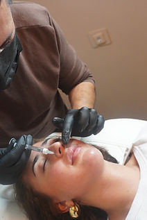 Lip fillers en facial fillers Amsterdam door BIG-geregistreerde arts - natuurlijke resulta