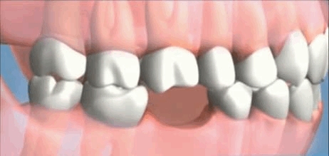 consequences of extraction.gif