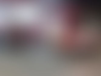 Homem fica ferido em colisão entre moto e trator no povoado Taquarí, em Penedo