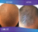 ProCellHairRegrowth_B_A-002.JPG