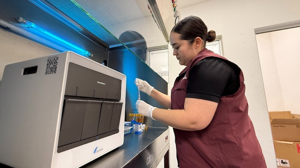 Baja California Sur fortalece la detección de Hepatitis C con nuevo equipo tecnológico