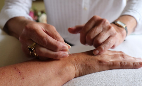 Caroline King Acupuncture