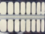Thumbnail: Lacy (Overlay)