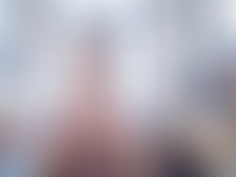 All-on-4 Explained: A Beginner’s Guide to Permanent Teeth in a Day