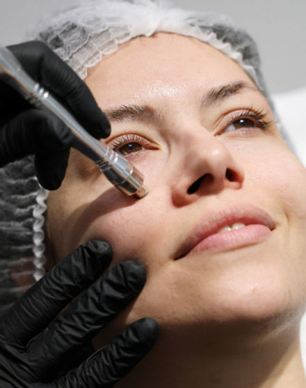 δερμοαπόξεση με διαμάντι - eloi beauty salon - αισθητική προσώπου