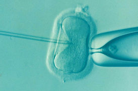 ivf-1514174_1920_edited.jpg
