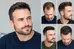 Best Hairstyles for Receding Hairlines