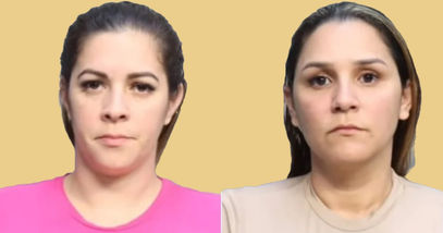 Detienen a Hermanas Cubanas por Operar Centro Postoperatorio Ilegal en Miami