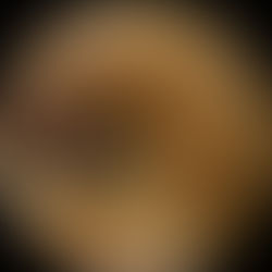 एस्परगिलस नाइगर के कारण कान में फंगल संक्रमण