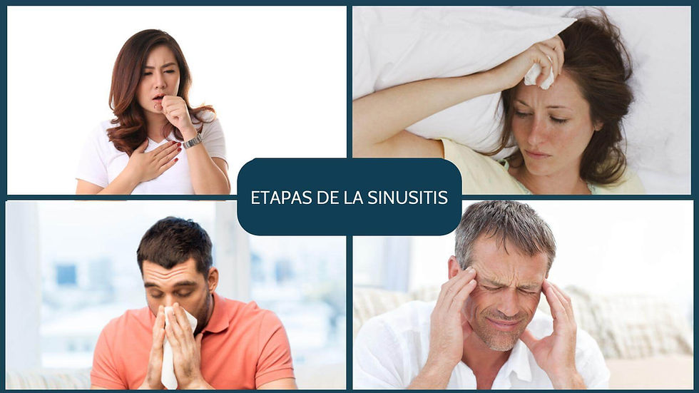 Etapas de la sinusitis: aguda, subaguda, crónica, aguda sobre crónica