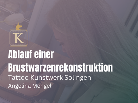 Wie läuft eine Brustwarzenrekonstruktion ab?