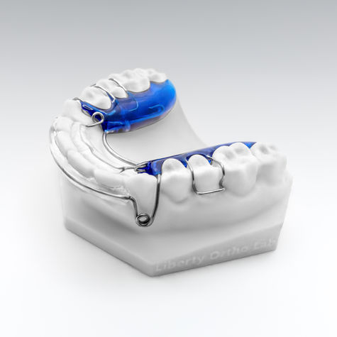 MODIFIED NITI ALIGNER 