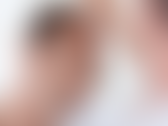 ¿Vale la pena un injerto capilar?