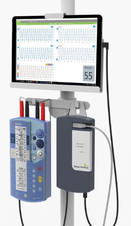 Professor Julian Paton discusses Ceryx pacemakers
