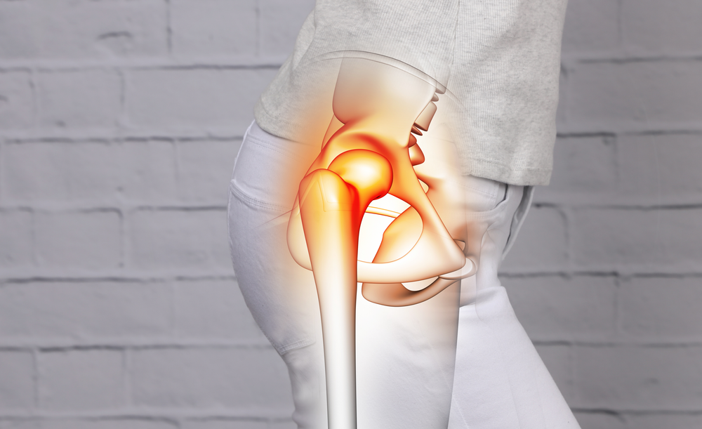 Hip Pain