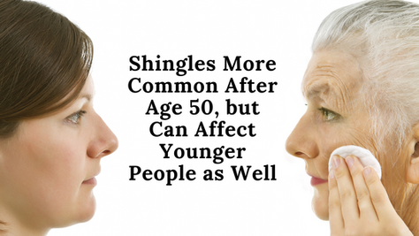 Shingles More Common After Age 50, but Can Affect Younger People as Well
