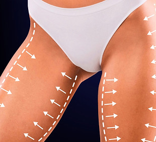 Post do instagram sobre prótese de silicone moderno em azul_edited.jpg