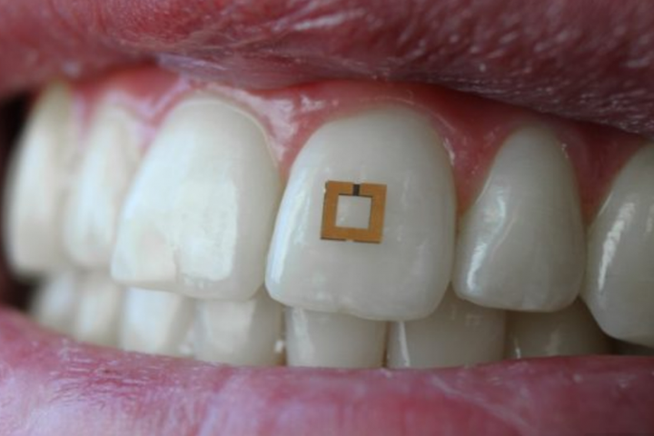 "Wearable" Ini Bisa Tahu Kebiasaan Makan dan Merokok