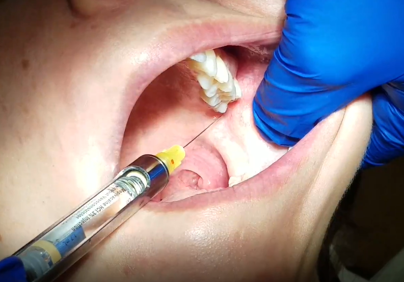 HIT ME WITH YOUR BEST SHOT GOWGATES