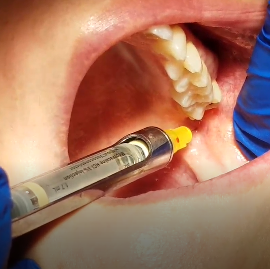 HIT ME WITH YOUR BEST SHOT GOWGATES